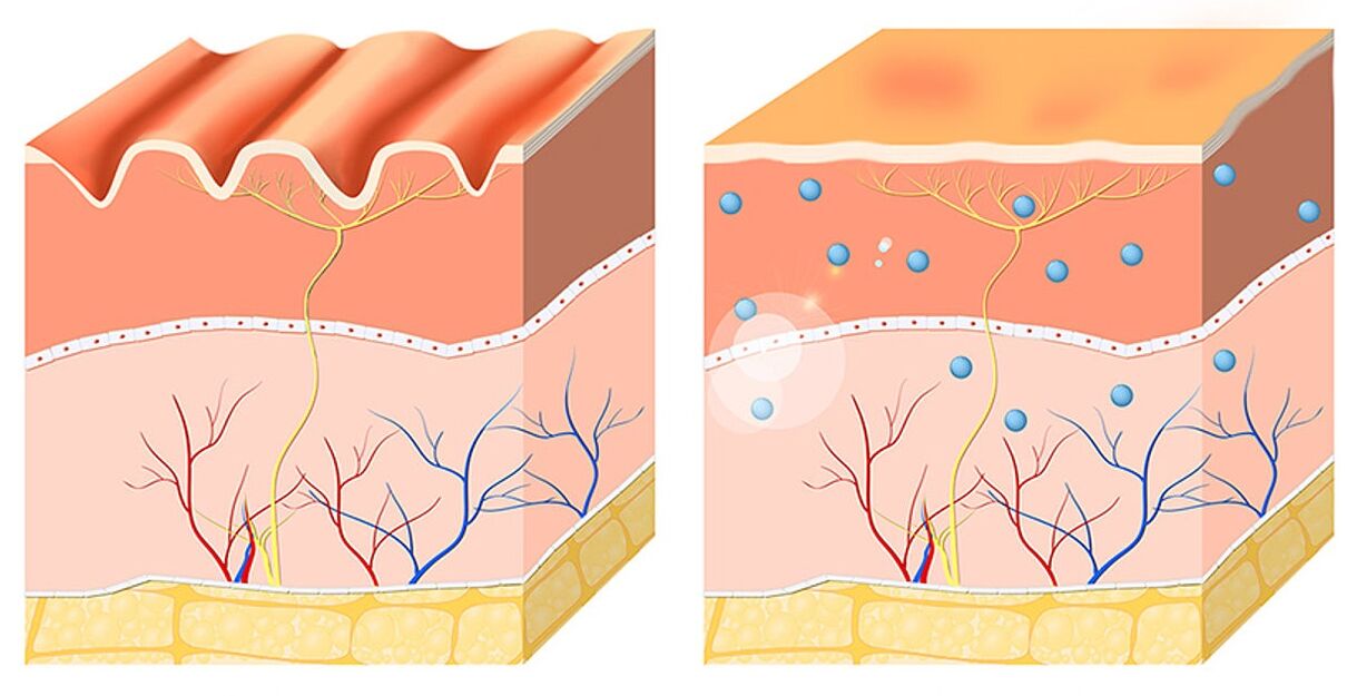 Inno Gialuron merata sareng moisturizes épidermis