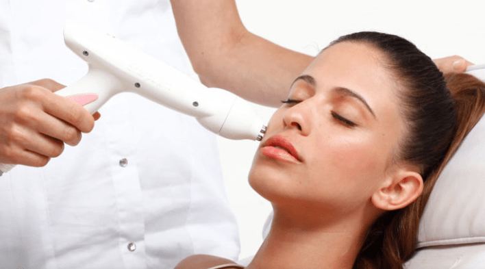 Laser rejuvenation rupina