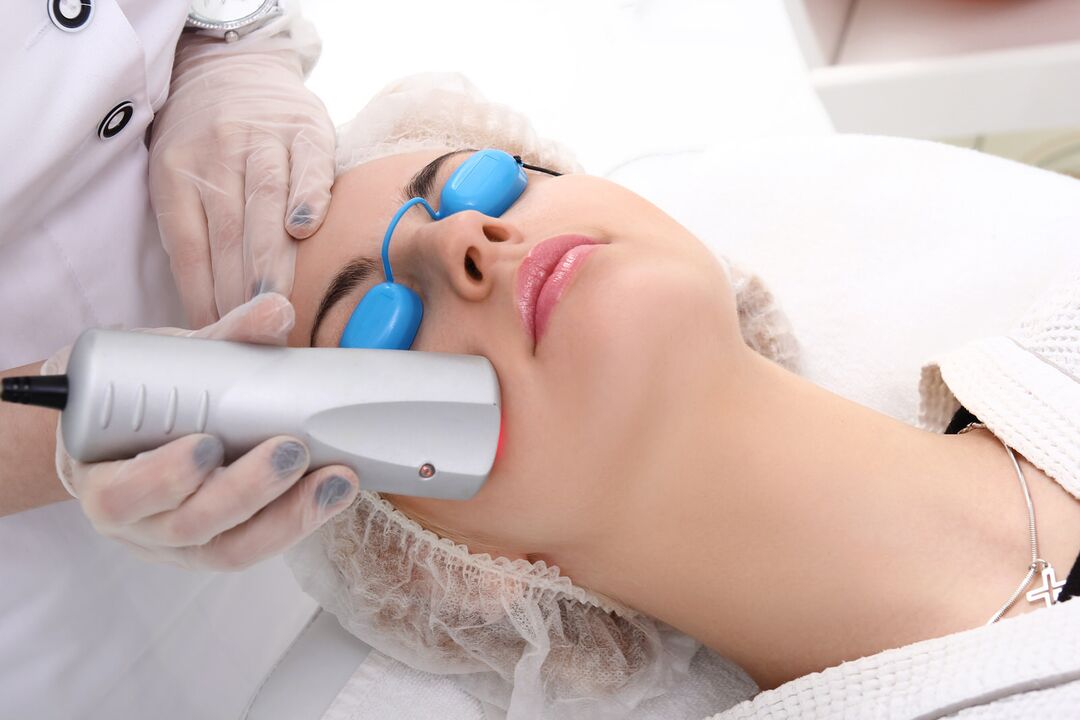 rejuvenation kulit laser