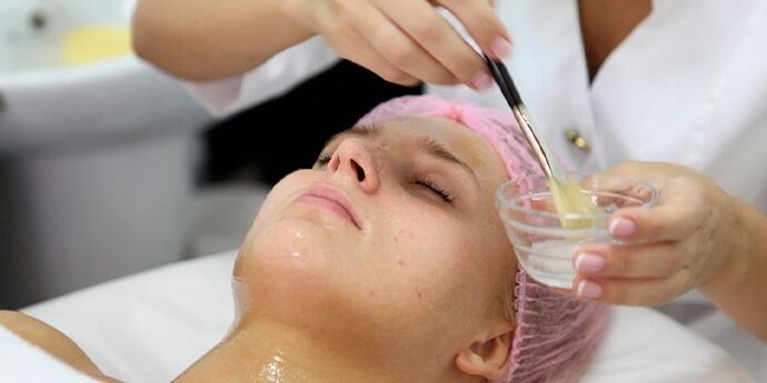 Hiji awéwé ngalaman prosedur peeling